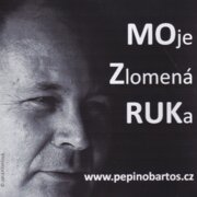 MOje Zlomená RUKa